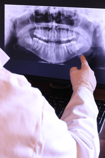 Best Chipped Tooth Repair Near Me  in Poseyville, IN